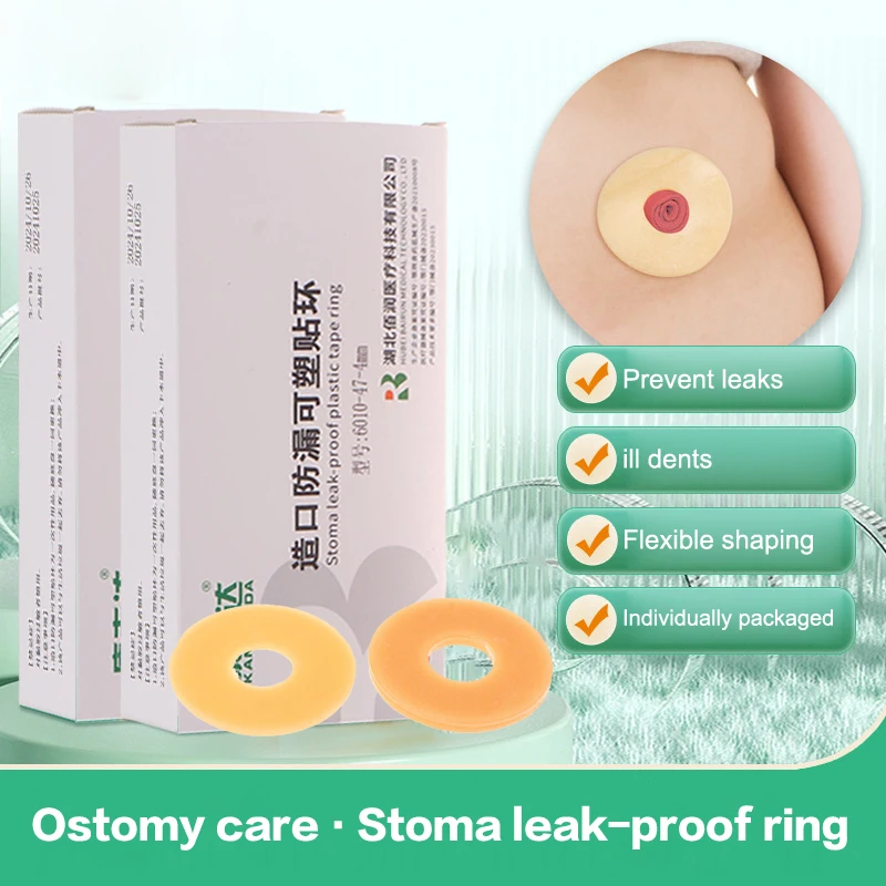 10 ks/boxu anti-leakačný prsteň pre kolostómiu tašku ostomia pasta kruhové baseplates Produkty stoma starostlivosť na ochranu pokožky na ochranu pokožky