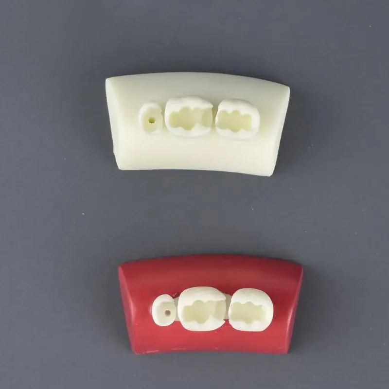 1pcs Peroral Faling Model Model zubného vložky Cvičenie Model Blokovanie cvičenia Typodont Materiály pre zubné lekárstvo Výučba Stud