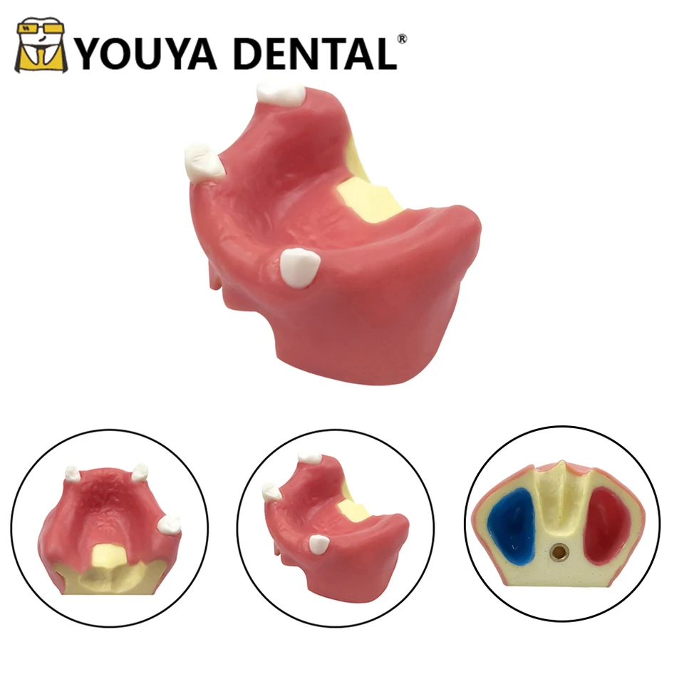 1pcs zubný model implantát implantát chýbajúce zuby Model Model zubný zubný implantát tréningový tréning Prax Perorálne výučbové modely