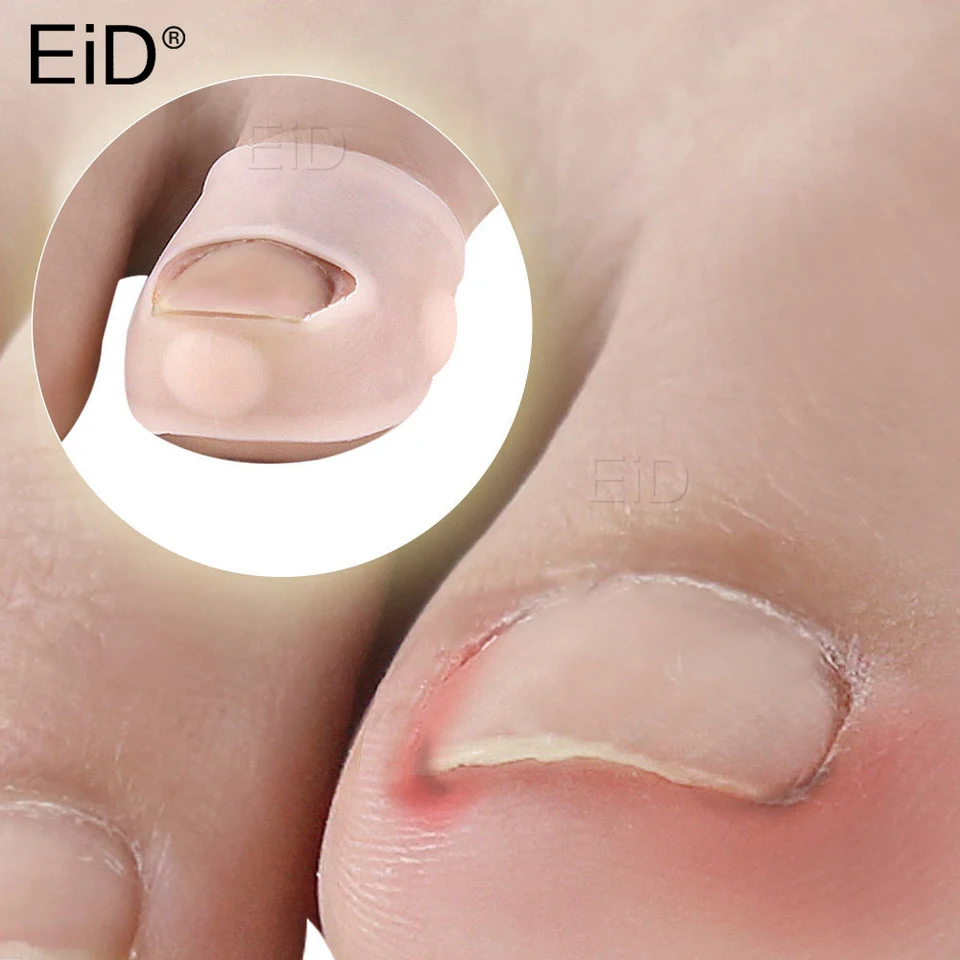2pcs Big Toe Protector Chránič palca Silikón mäkké priedušné nohy kukurice pľuzgie
