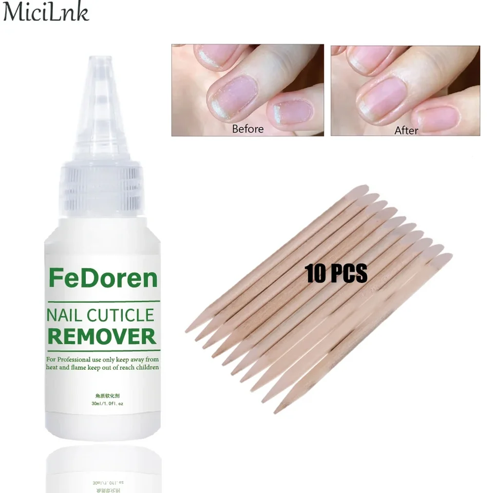 30 ml remover na nechty Kutíva Zmäkčovač tekutého opravy nechtov GEL GEL Exfoliator Cutice Ošetrenie manikúru Zmäkčanie mŕtvej pokožky pre starostlivosť o nechty