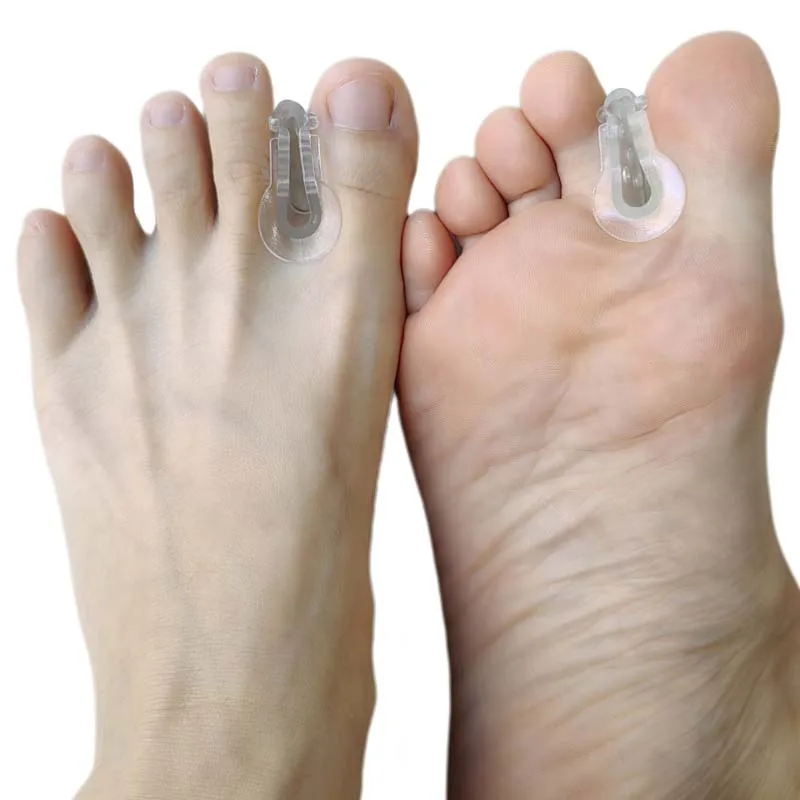 3Pair gélové kladivo na špičke nohy na nohy