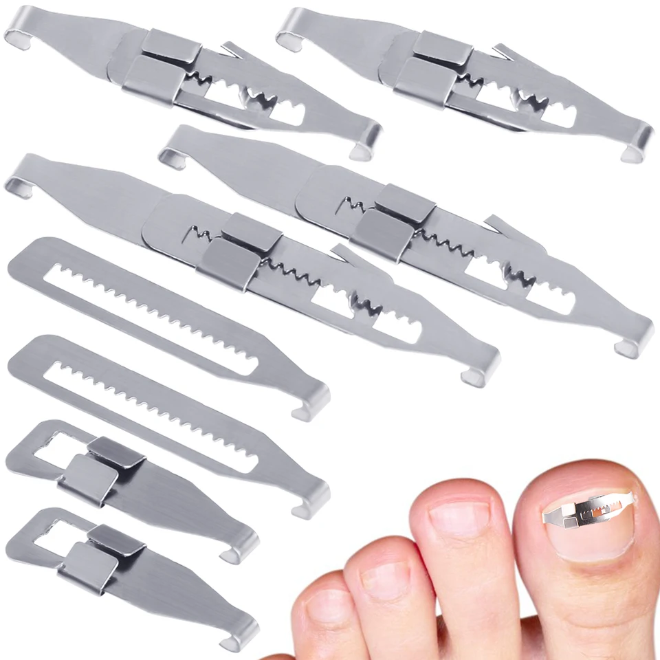 4/10pc uhlíková oceľ zakorenenie na nohách pedikúru Pedikúru korekcia korekcia Curved Brace Pečlenina hrubá korekcia paronychie
