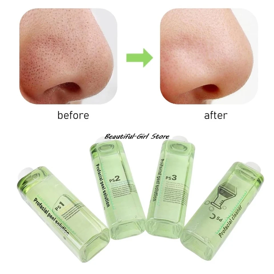 4 V 1 tvári Sérum Sérum odlupovacie roztok pre dermabrázový stroj Krása Krása Deep Cleaning Care Essence Essence Product Hydra kvapalina