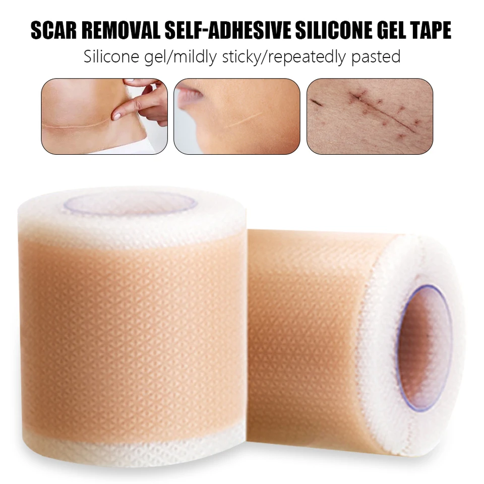 50-150 cm účinná chirurgia Odstránenie jaziev Silikónová gélová páska Self-adhezívna terapia Náplas