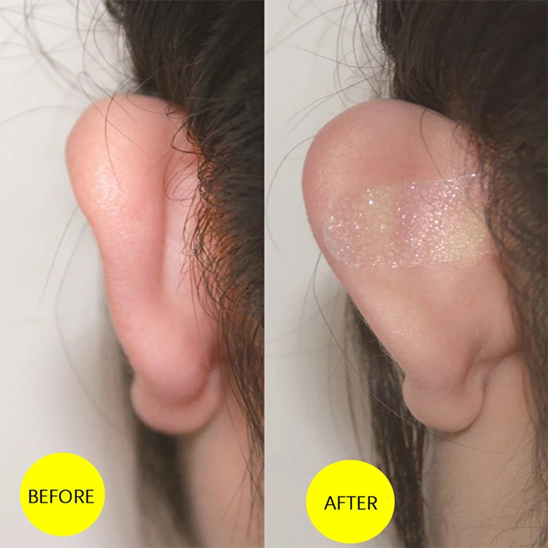 6 ks/hárok Kozmetický uší korektor ELF Elech Stuckers Silikón Self Adhesive Invisible Ear Stickers Face Displej malá pevná náplasť