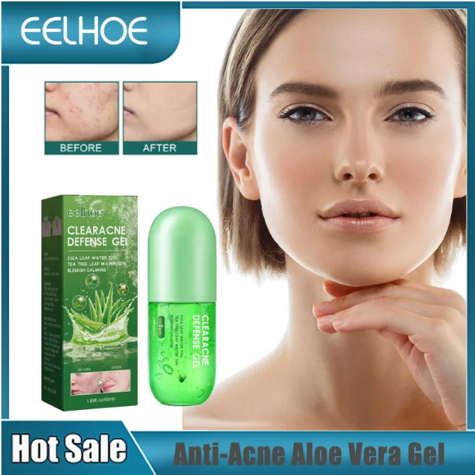 Aloe vera gél Pimple ošetrenie zmiznutím akné škvrny na odstránenie čiernej hlavy Zmršťovanie pórov Oil
