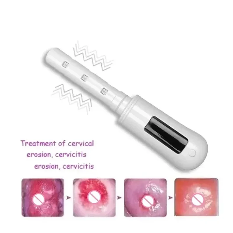 Bezdrôtový vaginálny masáž pre panvové zápalové terapeutické zariadenie červené modré svetlo pre gynekologickú vaginitídu Liečbu prístroja