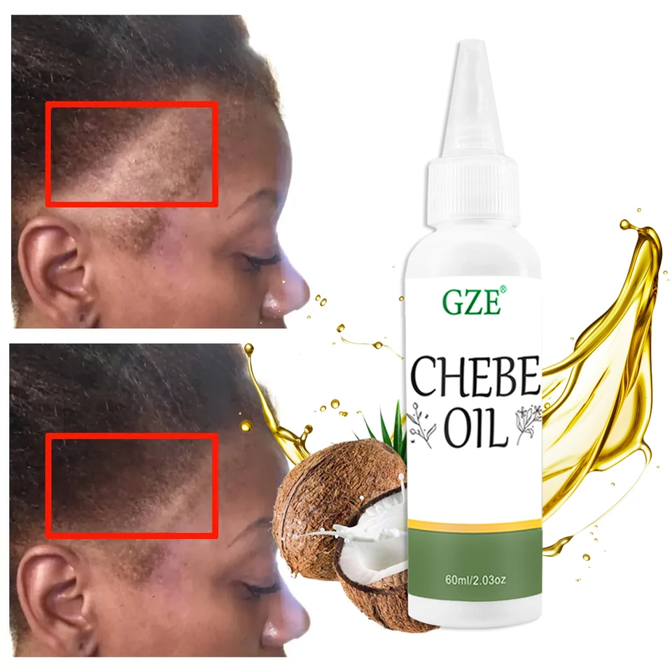 GZE chebe vlasový olej vyrobený z prášku chebe - africký chebe olej pre vlasy zahusťuje a posilňuje, svrbivá reliéf pokožky hlavy
