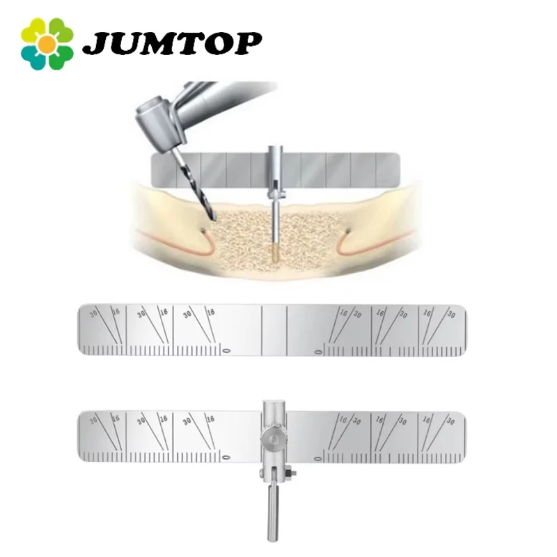 Jumtop zubný implantát lokalizačný sprievodca súprava pravítka