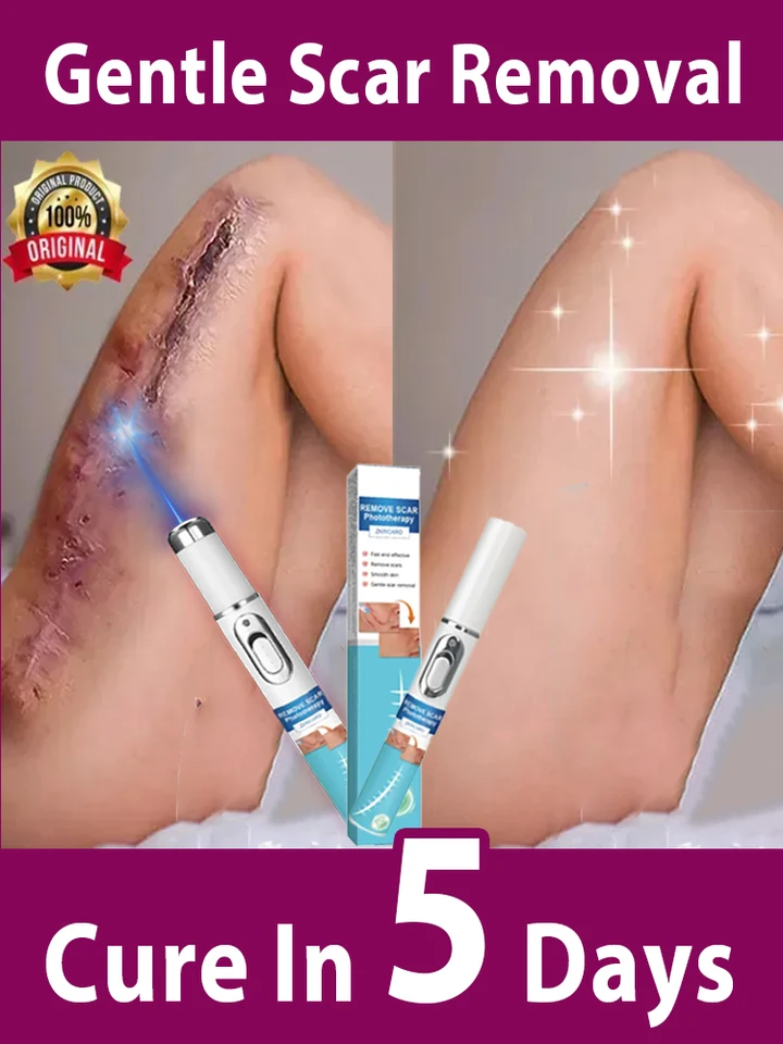 Krása 𝖲𝖼𝖺𝗋 𝖱𝖾𝗆𝗈𝗏𝖺𝗅