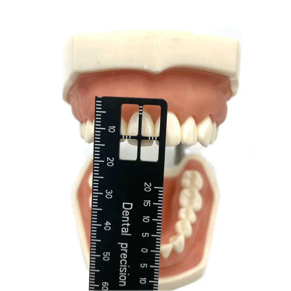 LyzDent 1pc zubná presnosť merania vládcu pre implantát a ortodonciu zubného lekárstva meracie prístroj