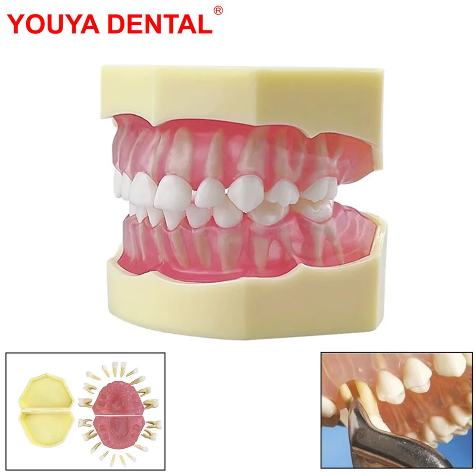 Model detských zubov pre tréningovú prax Model extrakcie zubov zubný štandardný model s odnímateľnými zubami Gums Deti Typodont