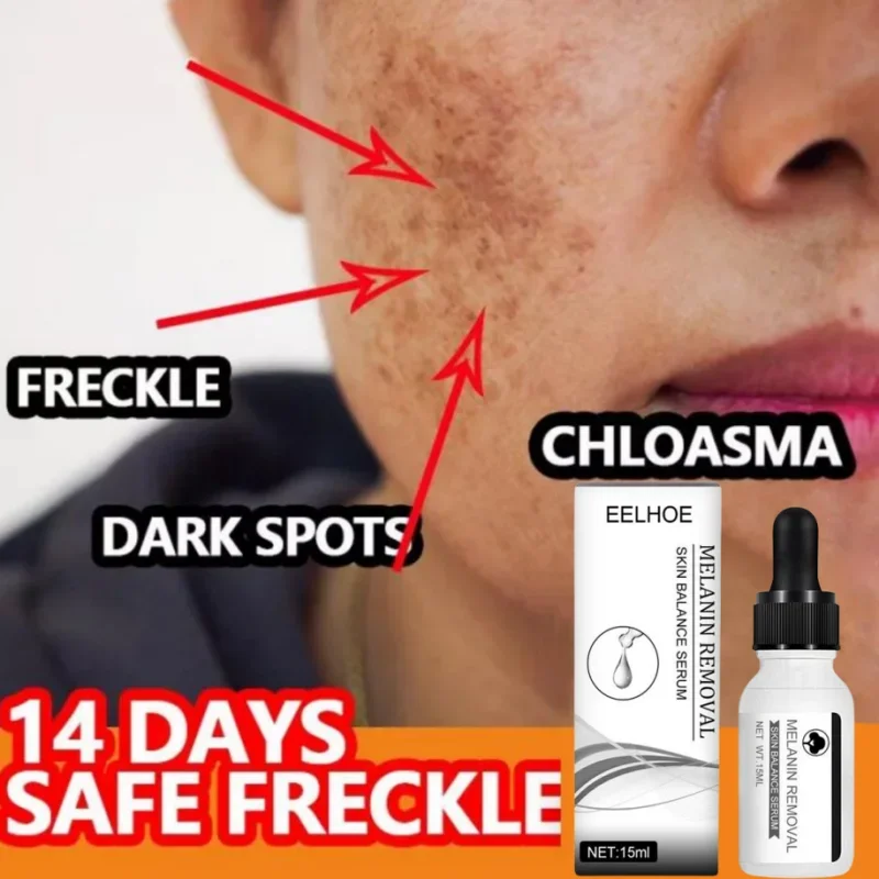 Niacinamid tmavý škvrnu Sérum Sérum Svetlé pehy rozjasniť pokožku s krémom pokožky Fade Pigmentácia melasma vlhkosť tváre starostlivosť o pleť