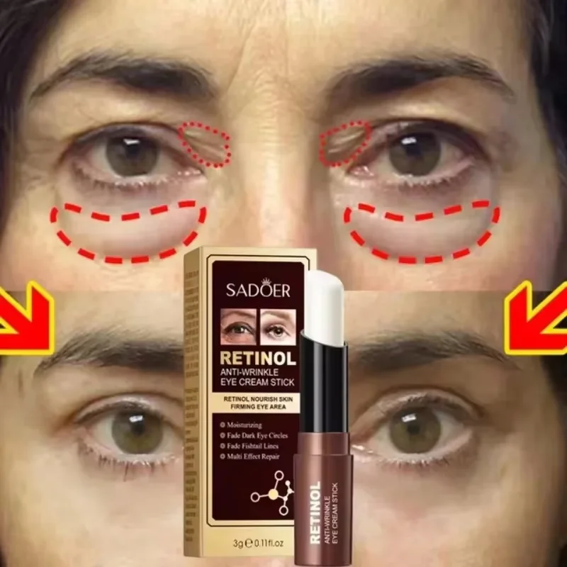 Okamžitá sťahová vrecká na odstránenie očí Retinol anti-vrátenia palice Flading Fade Fine Lines Anti tmavý kruh opúšťa