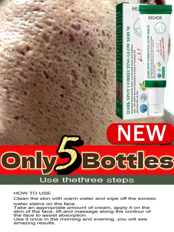 Opravy akné Pit Pit Muži a ženy na akné tlače Pit Acne Scar Cream protizápalový neoplácaný fade