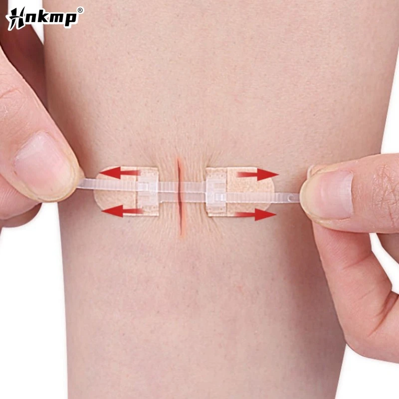 Popruh zipsové zákroky Uzatváracie záplaty priedušné plynulé obväzy na zips