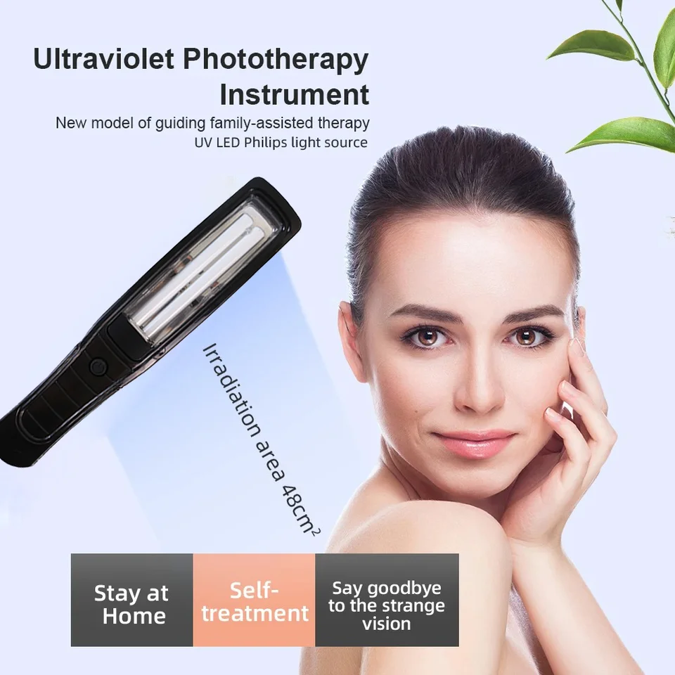 Psoriáza Vitiligo Liečba fyzikálnym terapiou Fototerapia Lampla 311nm UVB lampa pre fyzioterapiu Vitiligo