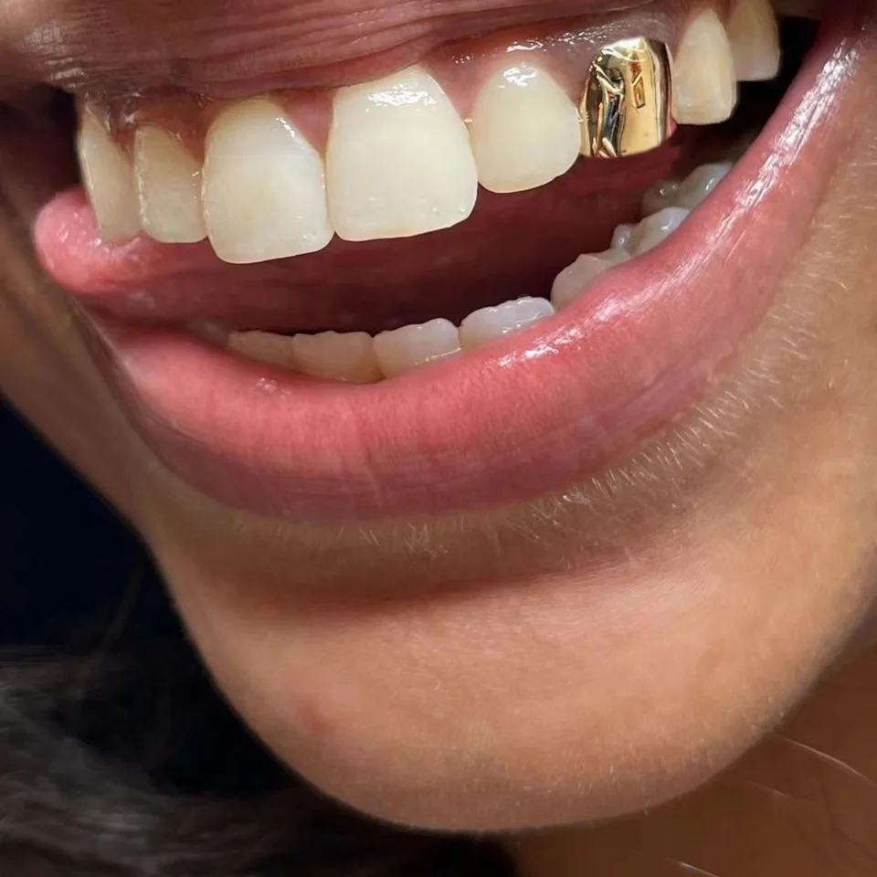 Rachelz klasický single lesklé zuby grilz hip hop 14k zlaté zubné čiapky dekor pre ženy