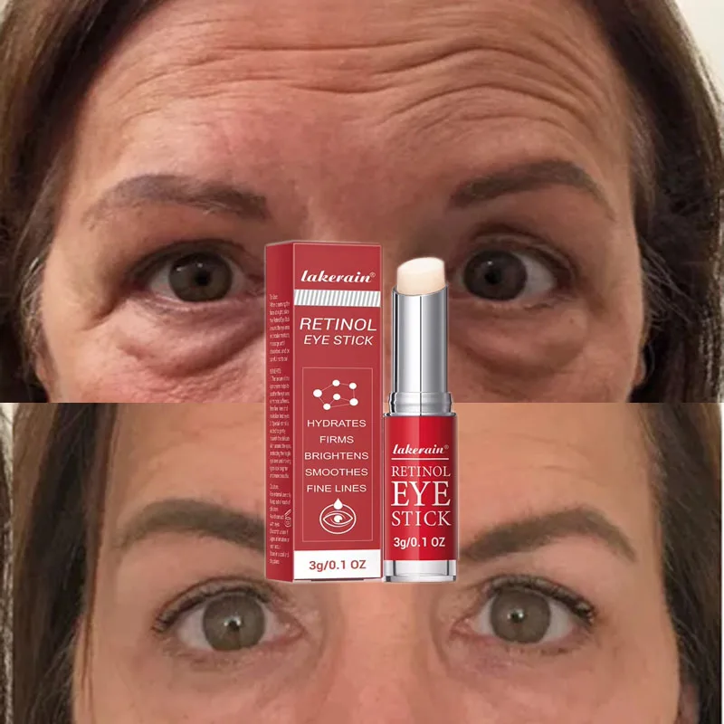 Retinol odstraňujte vrások očné tašky krém fasting fade jemné línie Anti-Puffiness Dark Circles opraviť očnú kožnú starostlivosť kozmetika kozmetika