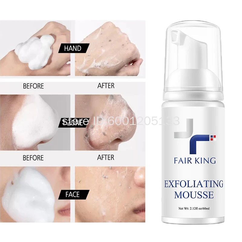 Rozlučovacia pena veľtrho King Zlepšuje textúru textúry pokožky Čistia make -up prach zlepšuje zväčšené póry absorbuje olejovú kozmetiku Veľkoobchod