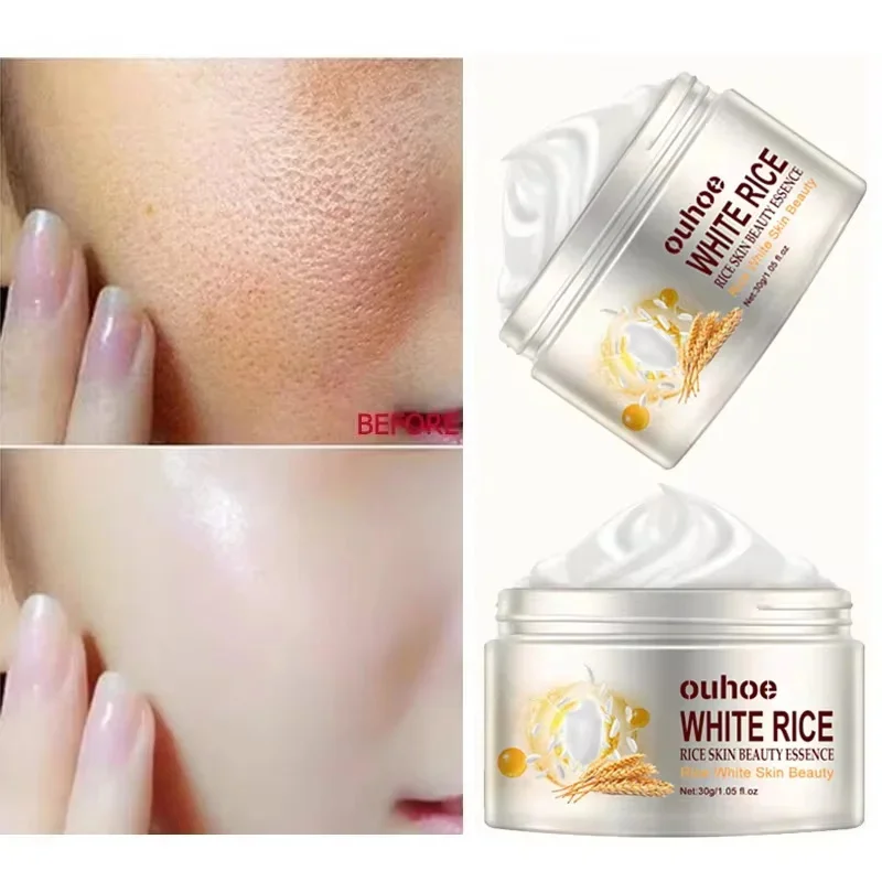 Ryžový protivinutý krém na tvár s akné melasma ošetrenie pigmentácia bieliacimi zvlhčovačmi kozmeta