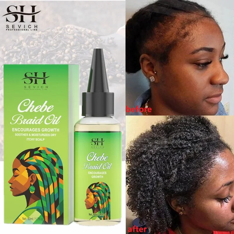 Sevich Chebe Rast Hair Serum Africa trakcia Alopecia Chebe Anti vlasy Liečba Clám