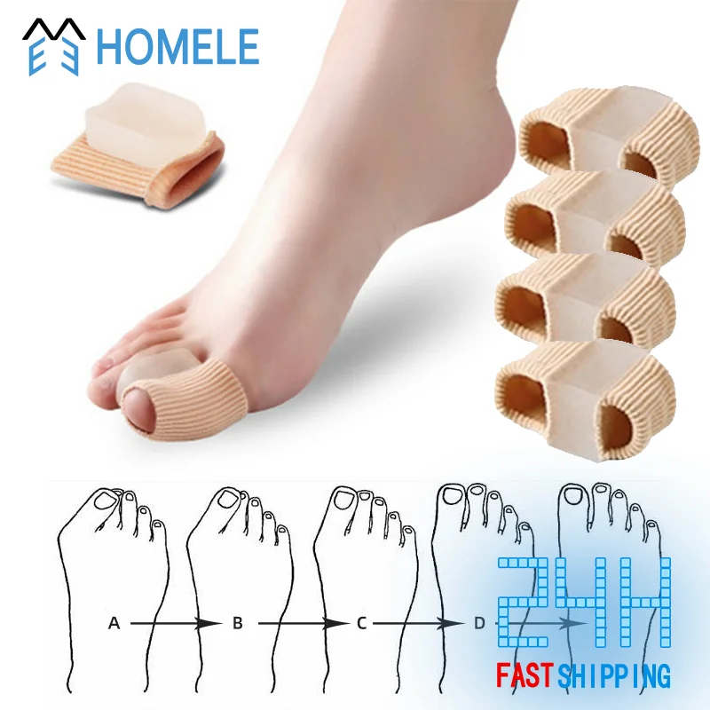 Toe separátor Hallux Valgus Corrector Bunions Bunions Bunions Separator Toe Corrector prsty nohy Haluksy špičky na špičke korektor