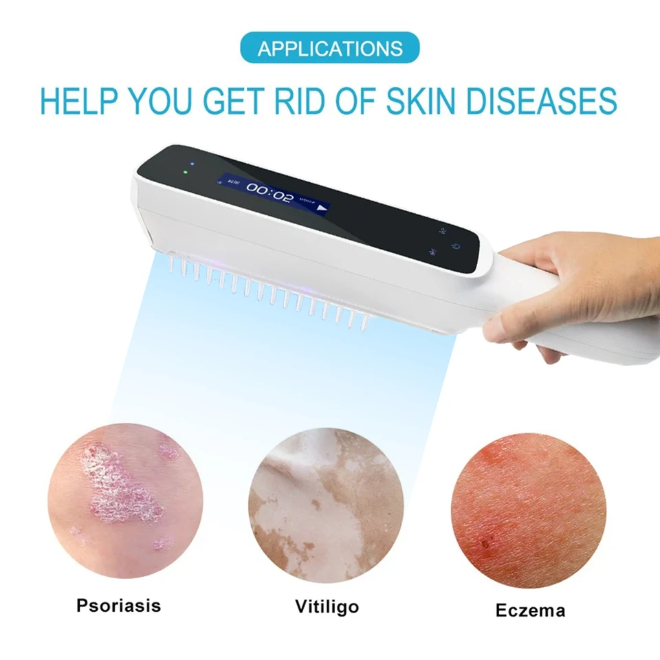 UV 311NM Ultrafialové fototerapeutické zariadenie na liečbu Vitiligo UVB lampy pre psoriázu, zariadenie na kožné ochorenie liečby ekzémom