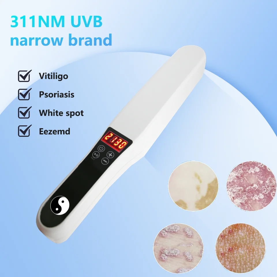 UVB 311nm úzko pásové svetlo Light Lamp pre psoriázu Vitiligo kožné ochorenie liečba Anti-biela škvrna UVB lampy