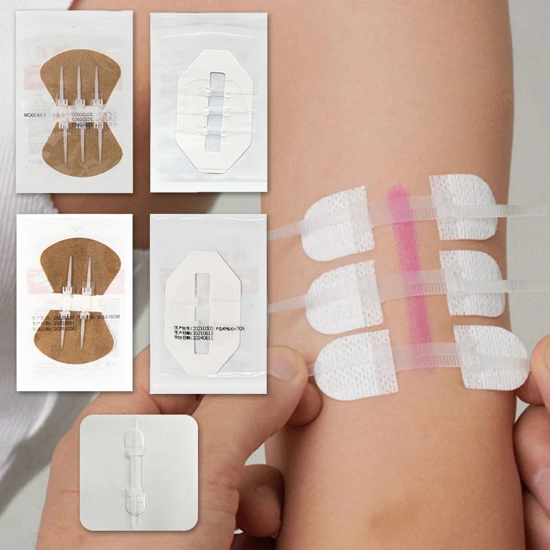 Uzatváranie pohotovostných rany Zip Stitch Stitus Bandaids Opravy rany bez stehov pre outdoorové aktivity rýchle rany zrazeniny