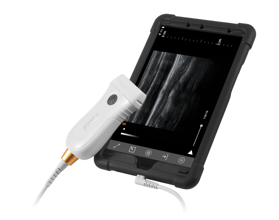 Veterinarinarusb Probe prenosná farba Doppler Pocket Vergeinary Ultrazvuk Diagnostický zobrazovací systém Tablet
