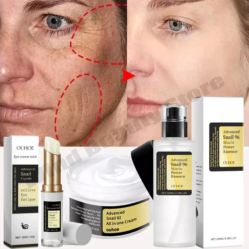 Vrások Remover Face Set Snail Serum tvár Zvlhčovač Firma výťah proti starnutiu Sérum Zmizne jemné línie bielia Kórejský originálny krém