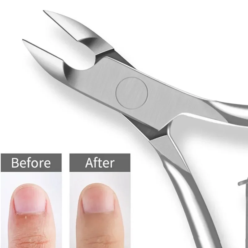 Z nehrdzavejúcej ocele kutikula Professional Remover Nožnice s nožnicami prstom manikúru nechty Clipper odumretý kožný náradie Sliver