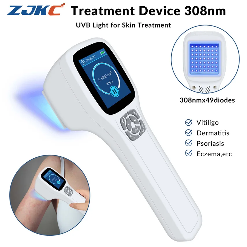 ZJKC 308NM excimerový systém psoriázový ošetrenie Blue UVB svetelná terapia Fototerapia pre kožné choroby Vitiligo 0-5J/CM2