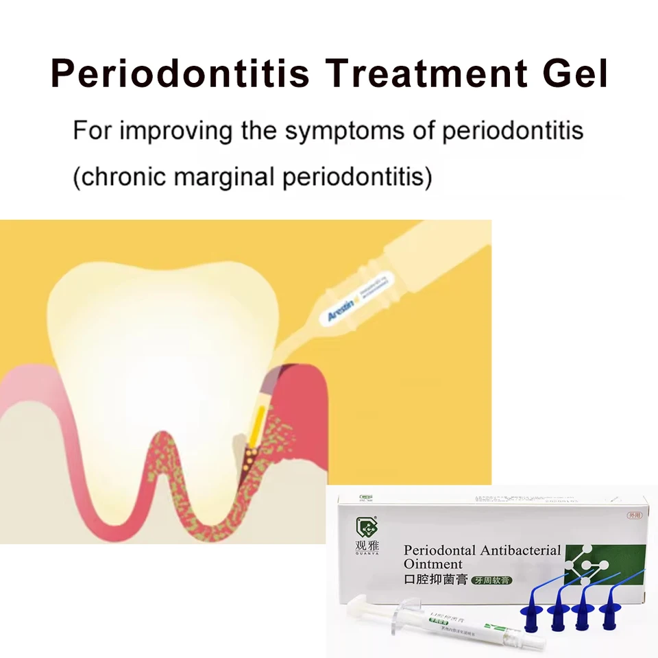 Zubné materiály Liečba periodontálnej choroby gél periodontitída ďasná gingivitíd