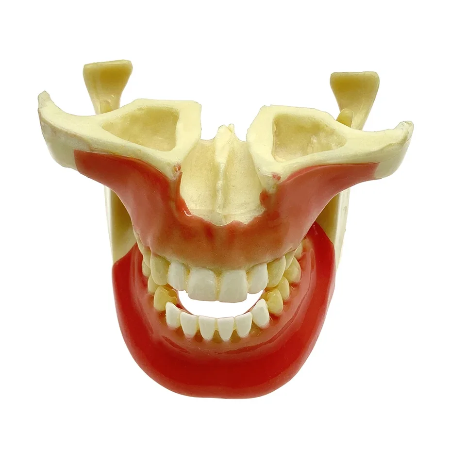 Zubné štúdium Ortho implantát Praktický model Výučba cvičenia pre doktor patologických demonštrácií zubov zubov