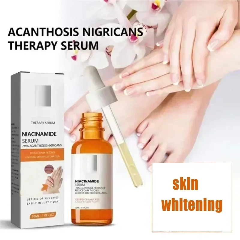 ⁿⁱᶜᵉ Tmavé kĺby bieliace sérum Sérum lakte podpazušia plážové sérum Sérum Demontáž na kožu Temné kĺby
